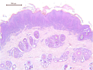 Photo 1 - Lésion cutanée à faible grossissement : dermatite hyperplasique/hyperkératosique, lichénoïde, d’intensité marquée.